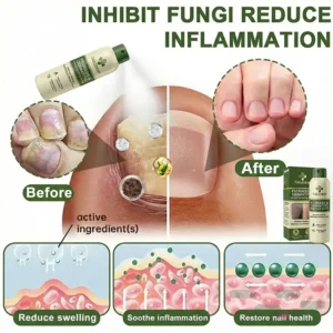 🔥𝗙𝗶𝗻𝗮𝗹 𝟯 𝗛𝗼𝘂𝗿𝘀: 𝟴𝟬% 𝗢𝗙𝗙:𝗧𝗔𝗜𝗟𝗘𝗗𝗘𝗡® 𝗠𝗮𝗴𝗻𝗲𝘀𝗶𝘂𝗺 𝗛𝗲𝗿𝗯𝗮𝗹 𝗣𝘀𝗼𝗿𝗶𝗮𝘀𝗶𝘀 𝗦𝗽𝗿𝗮𝘆