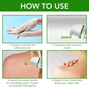 ✅ Official Store: TAILEDEN™ NatureErase Instant Mole & Spot Cream