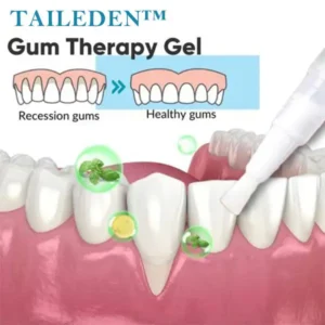(🔥LAST DAY SALE-80% OFF) TAILEDEN™ Gum Therapy Gel