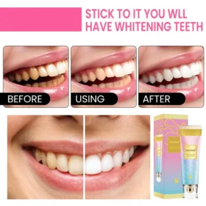 TAILEDEN™  Niacinamide Whitening Toothpaste