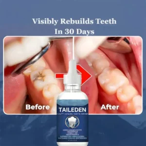 TAILEDEN™ Tooth Armor