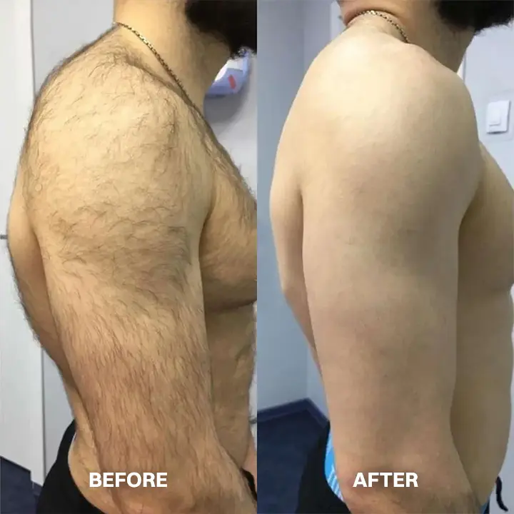 TAILEDEN™ Hair Removal Cream for All Women & Men