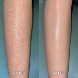 TAILEDEN™ Hair Removal Cream for All Women & Men