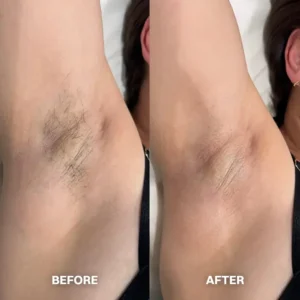 TAILEDEN™ Hair Removal Cream for All Women & Men