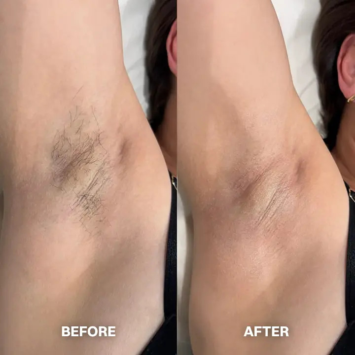 TAILEDEN™ Hair Removal Cream for All Women & Men