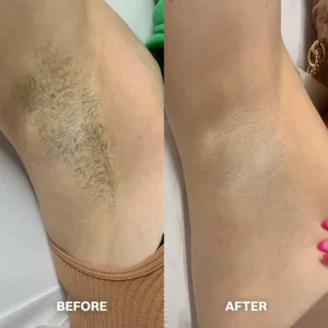 TAILEDEN™ Hair Removal Cream for All Women & Men