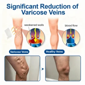 🇺🇸👨‍⚕️✅TAILEDEN® VeinEase Microneedle Care Patch⚡Instant Relief, Long-Term Results