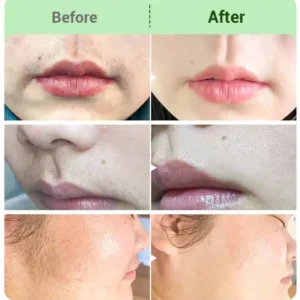 TAILEDEN™ Hair Removal Cream for All Women & Men-Discounted Repeat Purchase