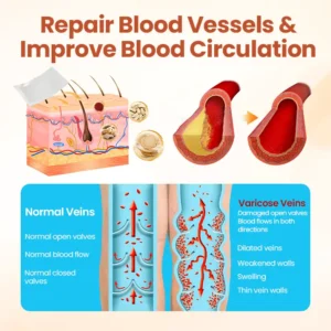 🚨TAILEDEN™ VeinTarget Microneedle Patch🚨Painless Varicose Vein Treatment at Home 🌿 — 60% MAX OFF! ⏳ Limited Time Offer!