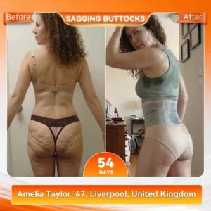 2TAILEDEN®+☀️𝐌𝐨𝐫𝐢𝐧𝐠𝐚 & 𝐁𝐞𝐫𝐛𝐞𝐫𝐢𝐧𝐞 4‑In‑1 Micro‑Particle Sculpting & Fat‑Burn Shorts