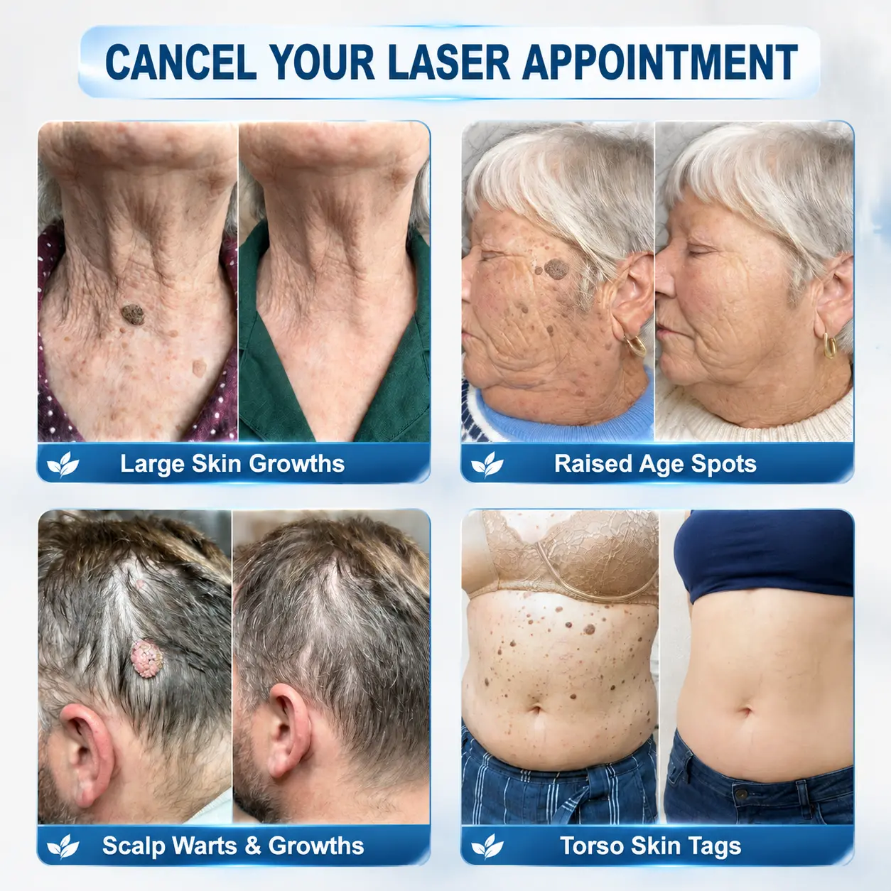 𝐎𝐟𝐟𝐢𝐜𝐢𝐚𝐥 𝐁𝐫𝐚𝐧𝐝 𝐒𝐭𝐨𝐫𝐞 |🔥TAILEDEN® 7-𝐷𝑎𝑦 𝗧𝐚𝐠 & 𝗦𝗽𝐨𝐭 𝐄𝐫𝒂𝒔𝒆𝒓(Zero Pain, Ze
– Pinepithgoods