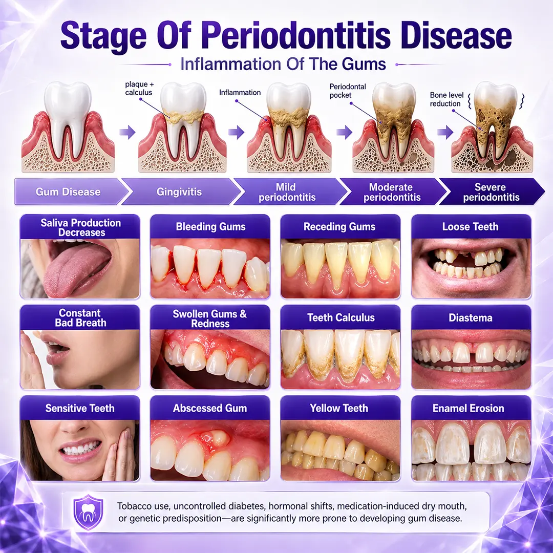 TAILEDEN® Gingivitis Periodontal Treatment Toothpaste